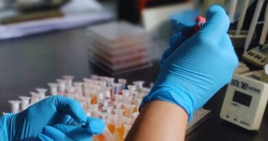 Tristeza Bovina, INTA, Vacunas, Laboratorio, Ciencia, Sanidad